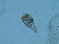 fig.06 テマリワムシ