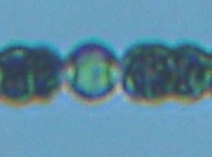 fig.09 アナベナ