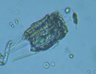 fig.06 ハネウデワムシ