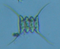 fig.09 イカダモ属(緑藻)