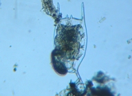 fig.07 ツノワムシ(卵)