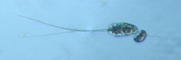 fig.11 ナガミツウデワムシ(卵)