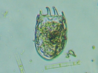 fig.06 ブタペストツボワムシ