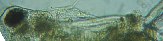 fig.03 牛久沼のオナガミジンコ(オス♂)
Diaphanosoma (male ♂)部分
