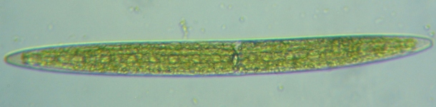 fig.10 ミカヅキモ