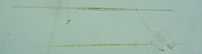 fig.02 TR΂̃Vlh