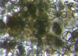 fig.07 ~NLXeBX