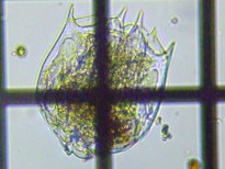 fig.05 カメガタツボワムシ