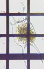 fig.06 カマガタツボワムシ