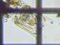 fig.09 ハネウデワムシ