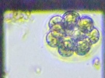 fig.11 タマヒゲマワリ