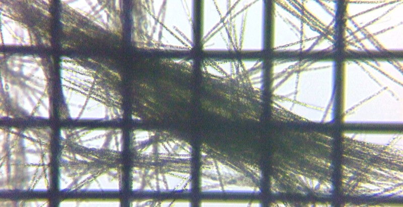 fig.01 At@j]m Aphanizomenon sp.